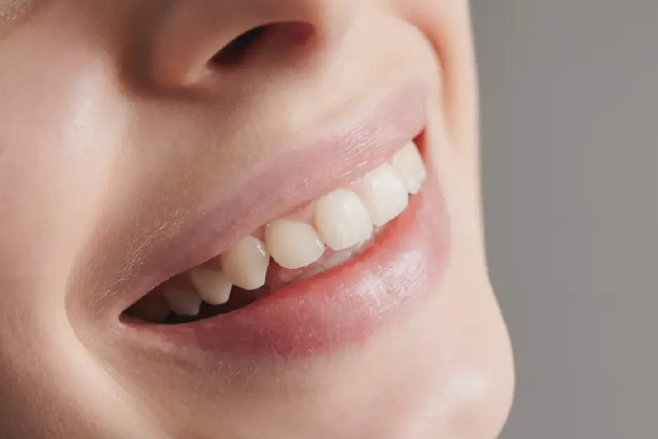 Dental Filling Aftercare Tips