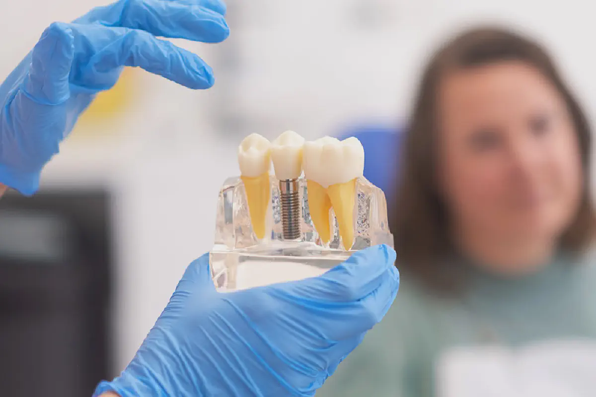 Comprehensive Guide to Dental Implants in Gresham, OR