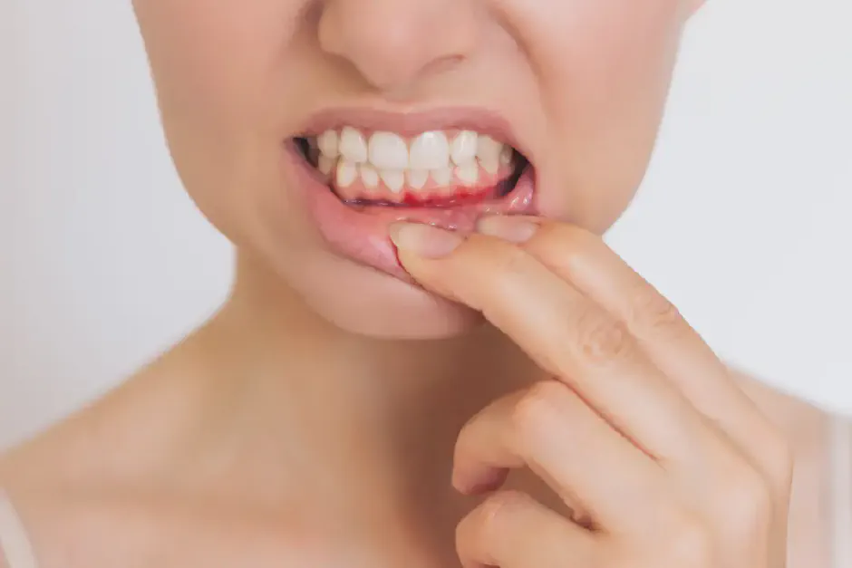 Proven Gum Disease Solutions in Gresham, OR - Smile Today