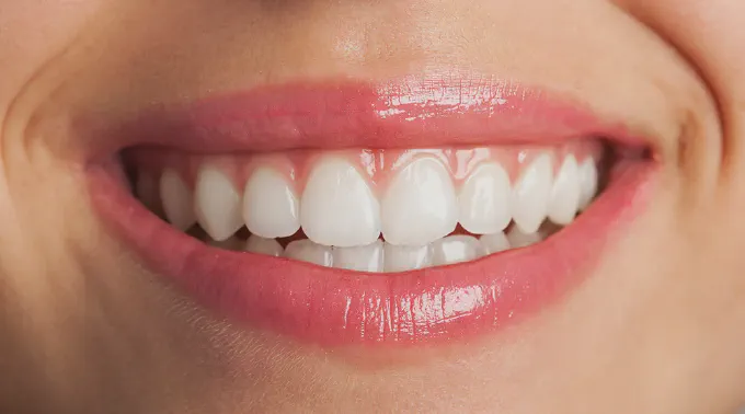 Perfectly white teeth