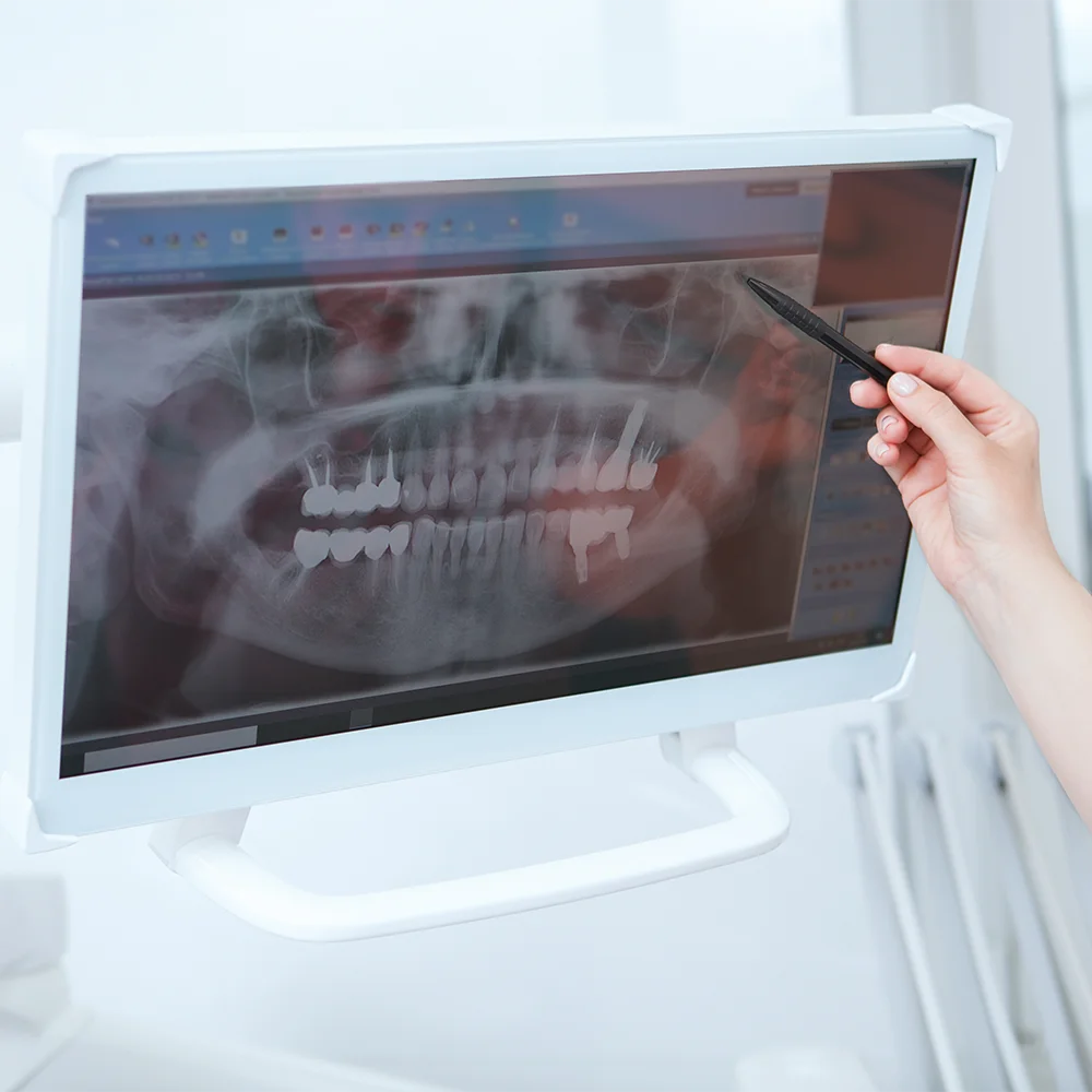 Dental Savings Plan Benefits