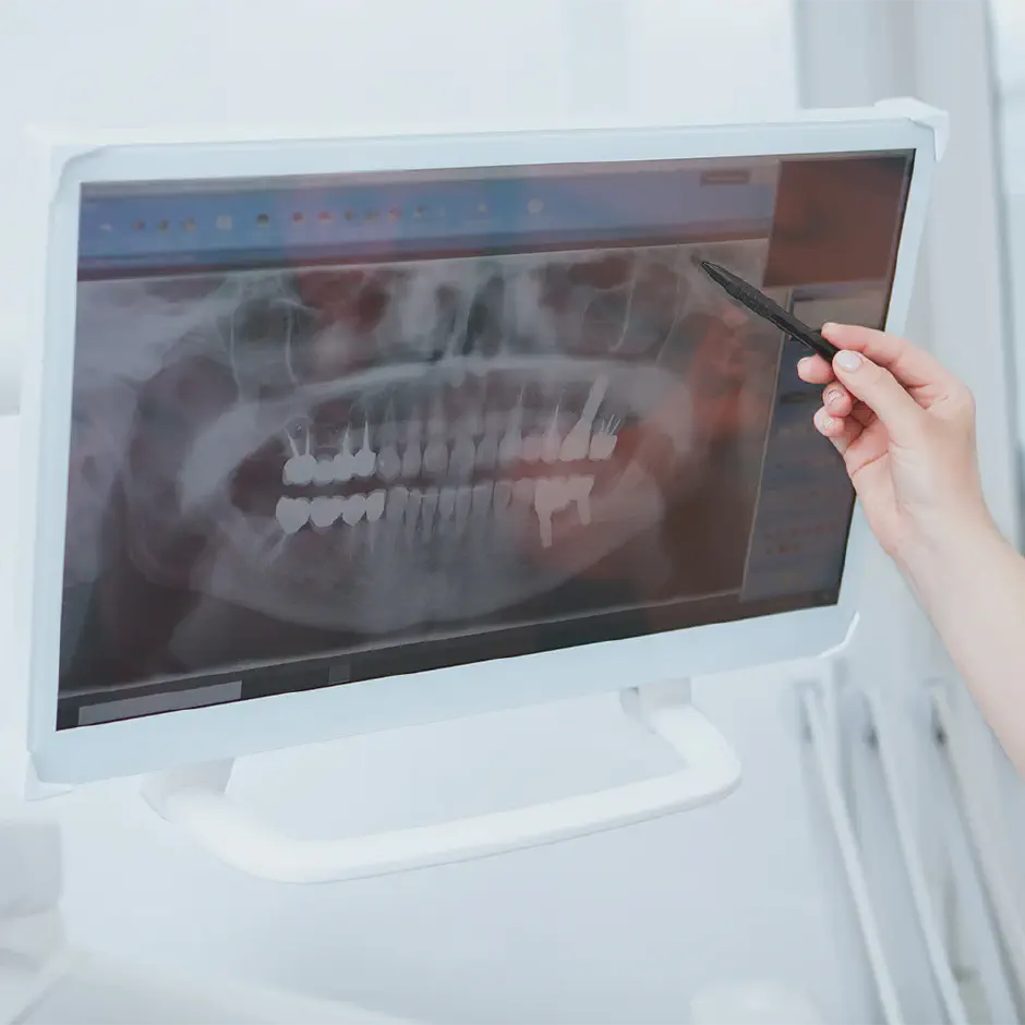 cropped shot female dentist pointing dental x-ray scan computer screen
