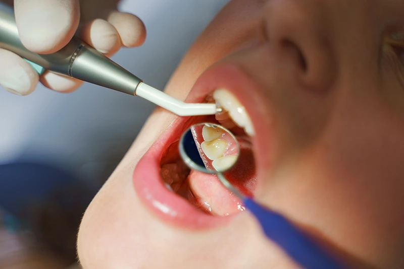 Close up of a young woman at dental examination.