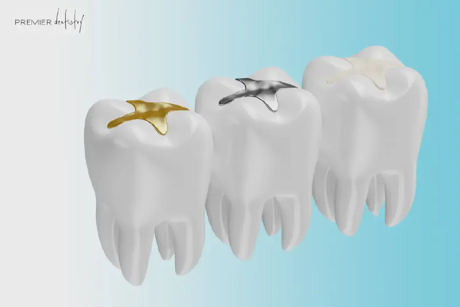 Cavity Fillings in Gresham - Natural Tooth Restorations
