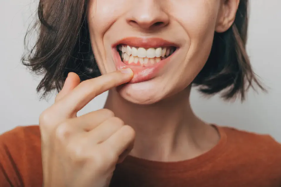 Diabetes and Gum Disease: How Blood Sugar Hurts Teeth
