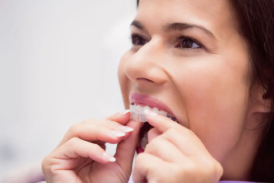 How to Clean and Care for Clear Aligners in Gresham