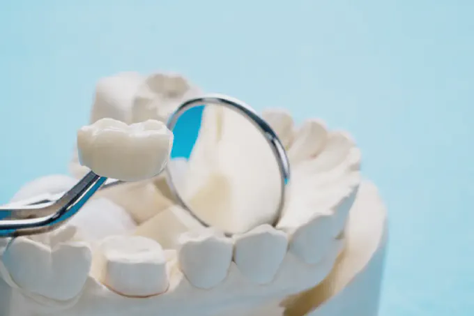 dental crown