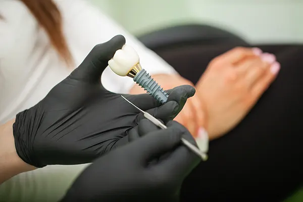 Close up of a dental implant.