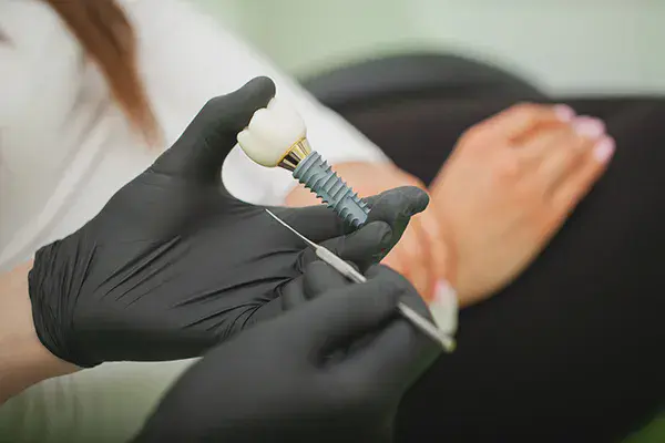 Close up of a dental implant