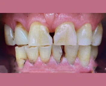 Before treatment, case 1