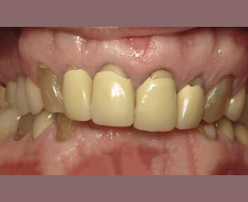 Before treatment, case 2